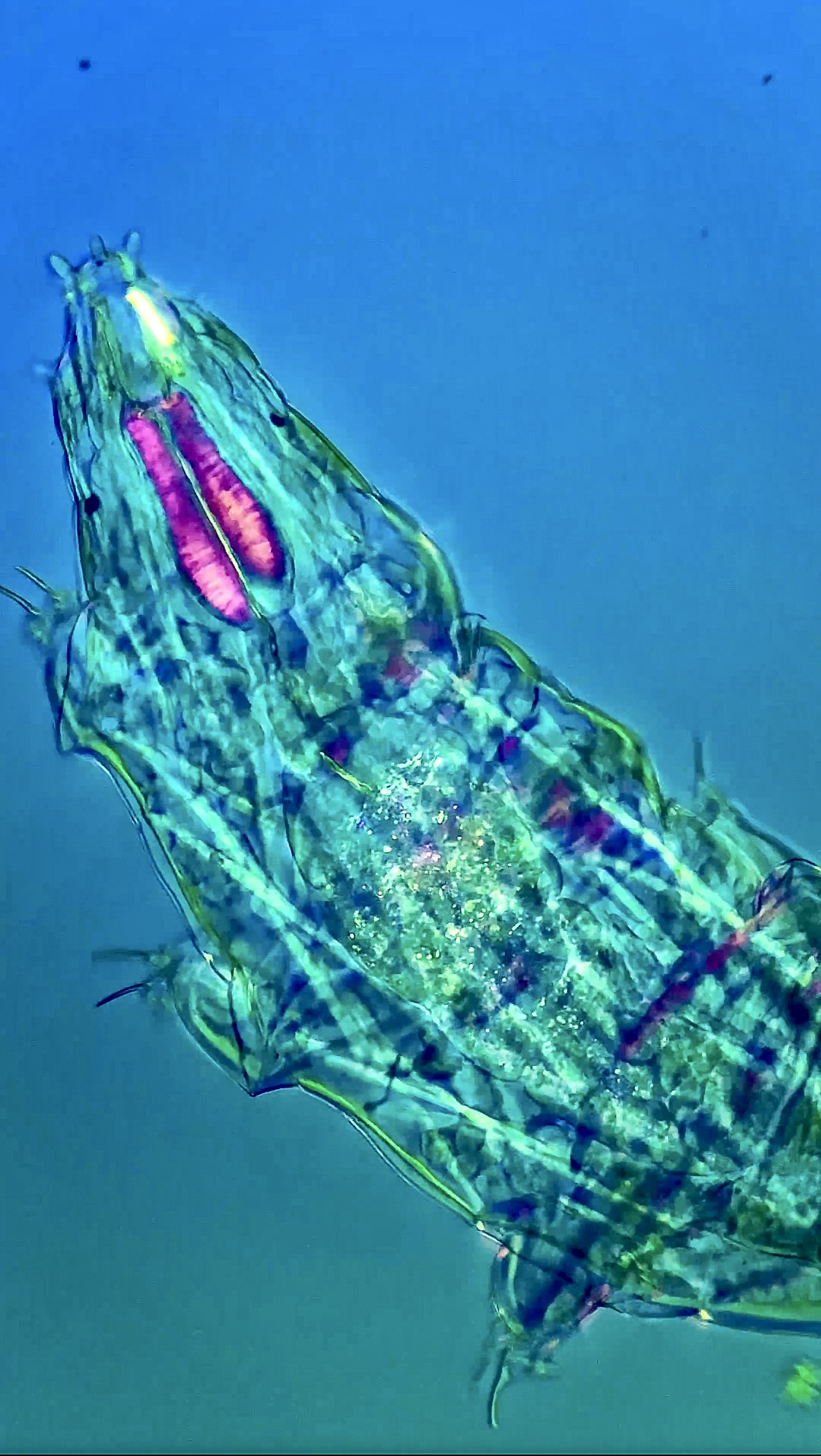 tardigrade